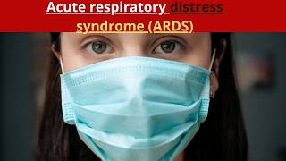 Acute respiratory distress syndrome ARDS [upl. by Nahrut962]