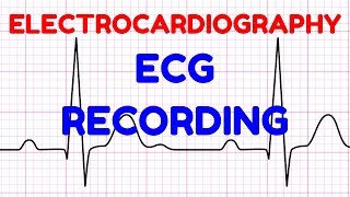 04 ECG RECORDINGELECTROCARDIOGRAPHY  ECG  CARDIOVASCULAR PHYSIOLOGY [upl. by Erdnoed]