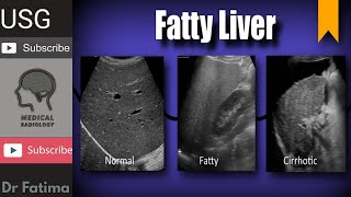 Liver normal echogenicity amp fatty liver with texture complete ultrasound lecture by DrFatima [upl. by Maiah420]