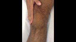 Knee Effusion Test  Selfassessment Swipe Test [upl. by Ruprecht]