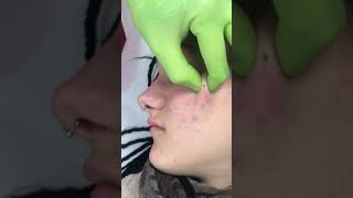 Microdermal piercing [upl. by Marciano]