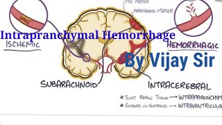 Intraparenchymal Hemorrhage by Vijay sir [upl. by Jutta988]