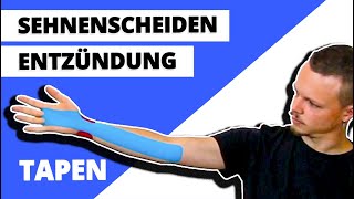 Sehnenscheidenentzündung tapen  Handgelenk tapen  Kinesiologie ANLEITUNG [upl. by Atinna601]