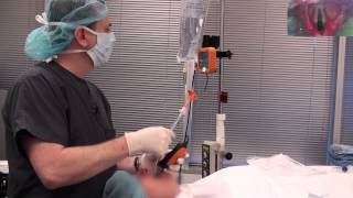 Video Laryngoscope stylet intubation [upl. by Muiram]