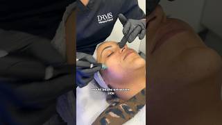 Signature Hydrafacial at Dr Medispa [upl. by Gauthier]