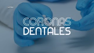 CORONAS DENTALES  DENTAL CALIFORNIA [upl. by Slaby273]