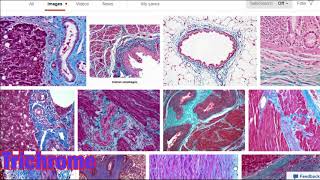 Histology stains such as eosin and hemotoxylin masons trichrome osmium tetroxide and more [upl. by Nylrad925]