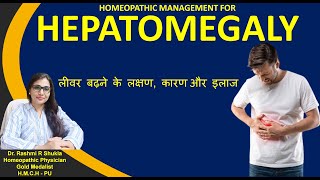 लिवर में सूजन साइज बढ़ने का ये है सही होम्योपैथिक इलाज Hepatomegaly best homeopthic treatment [upl. by Dyrrej150]