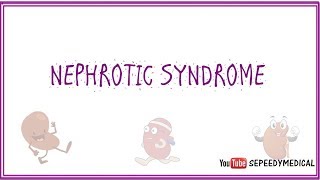 Nephrotic Syndrome Made Easy [upl. by Trula]