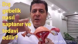 Dış ektopik gebelik nasıl oluşur ilaçla tedavisi nasıl yapılır ve tanı konamazsa ne olur [upl. by Lihkin]