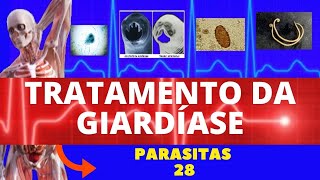 TRATAMENTO PARA GIARDÍASE GIARDIA LAMBLIA  COMO RESOLVER A GIARDÍASE  PARASITOLOGIAINFECTOLOGIA [upl. by Aninaig]