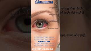 Glaucoma Symptoms docter video medical medicine trending facts [upl. by Mckee]