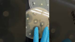 Microbiology Antibiotic Susceptibility Resistance and ESBL Part 1 [upl. by Flanders]