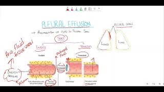 Transudate vs exudate  Respiratory system diseases  NCLEXRN  Khan Academy [upl. by Ymmor]