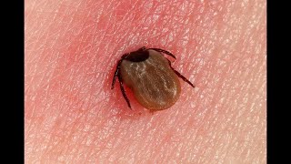 Lyme Disease Blocks Vitamin D Absorption by 8000 [upl. by Sartin]