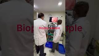 UPPER GI Endoscopy EsophagoscopyGASTROSCOPY Duodenoscopymbbs medical doctor byDr Raj mishra [upl. by Joseph]