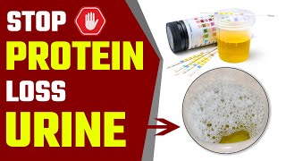 How to Stop Protein Loss in Kidney Failure  Foamy Urine  Proteinuria  Bharat Homeopathy [upl. by Atsev212]