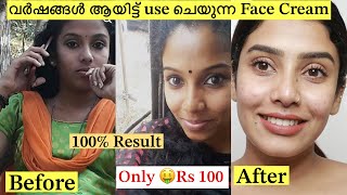 💯Result Best skin Brightening Cream 🧴❌No Side Effects 😎glamyganga [upl. by Yasmine]