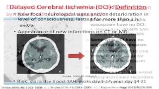 ICU Management of Subarachnoid Hemorrhage by Amedeo Merenda MD [upl. by Strauss]