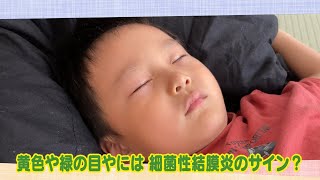 【公式】「黄色や緑の目やには 細菌性結膜炎のサイン？」（10月29日放送）｜テレビ西日本 [upl. by Ultima]