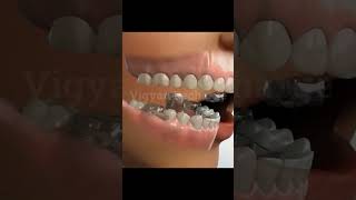 Jaw Treatment teeth dentist health [upl. by Nrol]