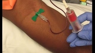 Phlebotomy Procedure Venipuncture with 21G Butterfly education phlebotomy tutorials [upl. by Yltsew365]