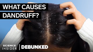 Hair Experts Debunk 15 Hair Myths  Debunked [upl. by Admana]