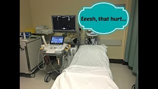 Eeesh that hurt Saline Sonogram [upl. by Donnell]