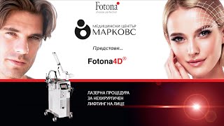 Fotona4D  новата лазер терапия за нехирургичен лифтинг на лице в МЦ МАРКОВС [upl. by Ayerdna]