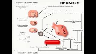 Takotsubo Cardiomyopathy I am Seeing it Everywhere [upl. by Annij]