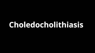 Choledocholithiasis [upl. by Catriona97]