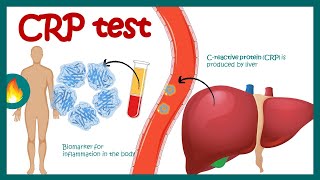 CReactive Protein CRP  Inflammation  Acute phase reactant  How do you read CRP test results [upl. by Eirhtug854]