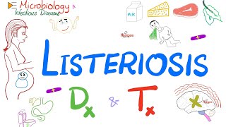 Listeria monocytogenes Listeriosis  Diagnosis and Treatment  Microbiology 🧫 [upl. by Annelise]