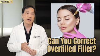 How to Fix Overfilled Migrated Filler Face  Wave Plastic Surgery [upl. by Elleirda]