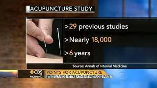 Acupuncture treatment reduces pain study [upl. by Atirihs]