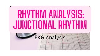 EKG Rhythm Analysis Junctional rhythm [upl. by Hamburger]