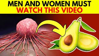 BE AWARE If Youve Eaten AVOCADO Watch This Even One Can Trigger an IRREVERSIBLE Reaction [upl. by Dlanod]