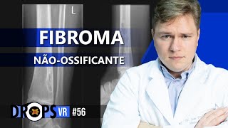 FIBROMA NÃO OSSIFICANTE NO RAIO X [upl. by Tufts958]