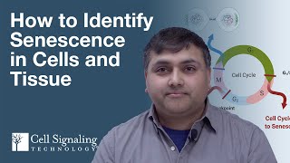 How to Identify Senescence in Cells and Tissue  CST Tech Tips [upl. by Tobie]