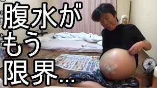 【金バエ】悲報 腹水が限界を超えている事を語る【肝不全 余命1年】 20240112 [upl. by Ely]