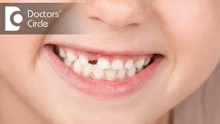 How to manage avulsed tooth  Dr Shyam Padmanabhan [upl. by Norted]