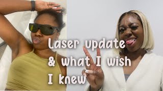 6 Month Laser Hair Removal Update amp 5 Things I wish I knew before Starting Laser [upl. by Ahtnamas801]