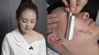 💈ASMR  Remove a lot of vellus hair from a mans face Shave the head 🪒 Wonderful shaving [upl. by Ailugram]