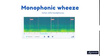 Lung sounds  monophonic wheeze [upl. by Llechtim]