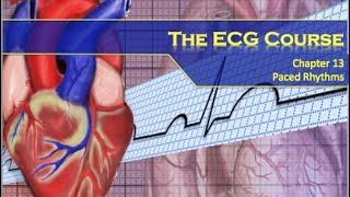 The ECG Course  Paced Rhythms [upl. by Rafaj101]