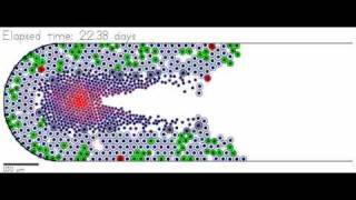 Ductal carcinoma in situ DCIS simulation [upl. by Hoem]