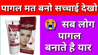 skinkler cream  skinkler cream side effects in hindiskinkler cream review in hindi [upl. by Ille648]