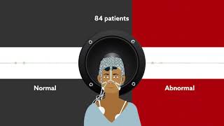 Detecting Silent Seizures By Their Sound Video Abstract [upl. by Leina]