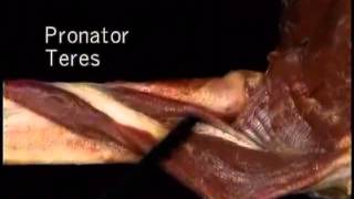 pronator teres muscle [upl. by Atinrahs310]