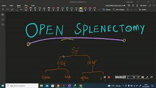 OPEN SPLENECTOMY IN COMPLETE DETAIL [upl. by Hanser]